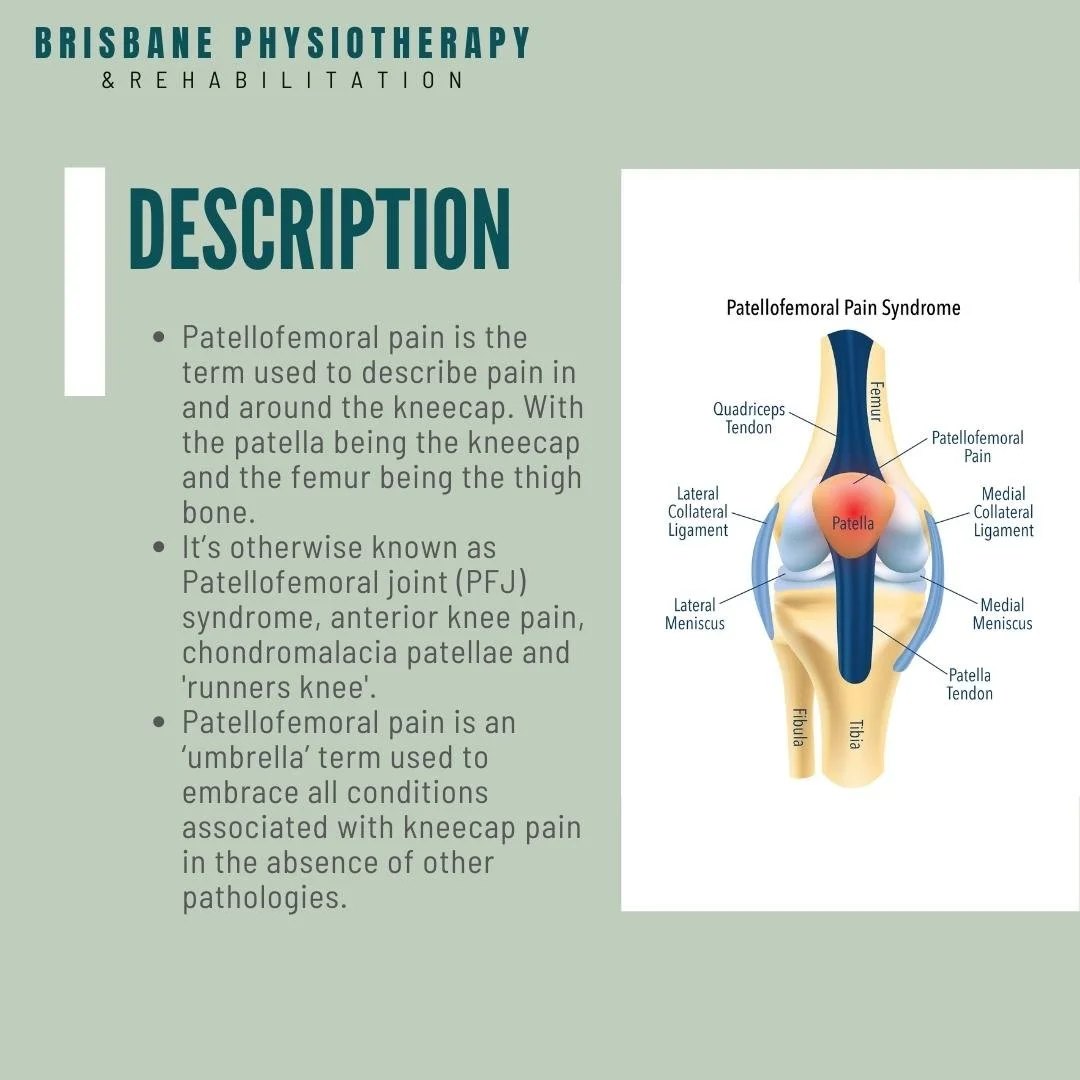 What is Patellofemoral Pain Brisbane Physiotherapy